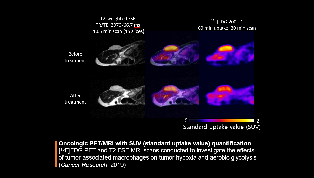 Oncologic PET/MRI with SUV (standard uptake value) quantification