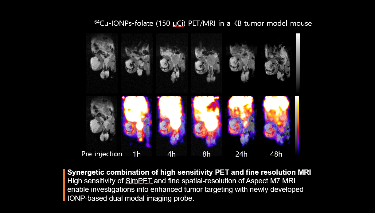 Synergetic combination of high sensitivity PET and fine resolution MRI 